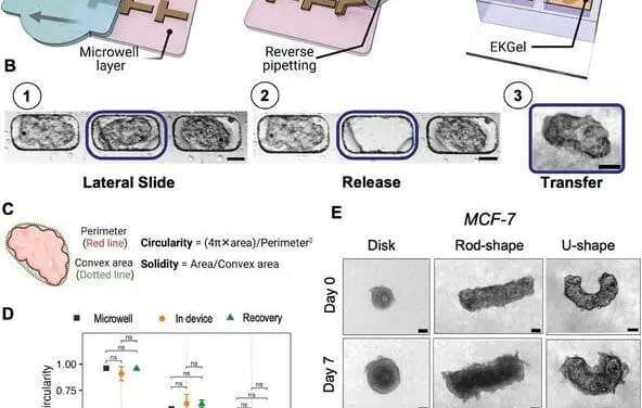 Mikrofluid-Plattform: Form des Tumors verrät Aggressivität der Krebserkrankung