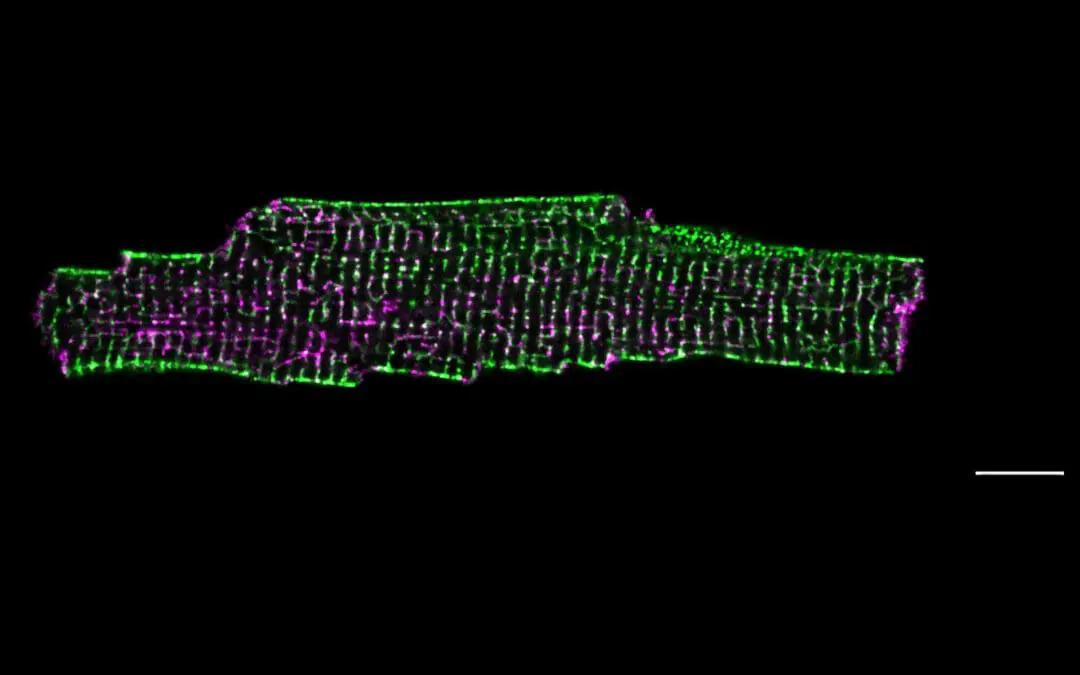 Herzschwäche: Protein Dysferlin schützt und formt die Membran von Herzmuskelzellen