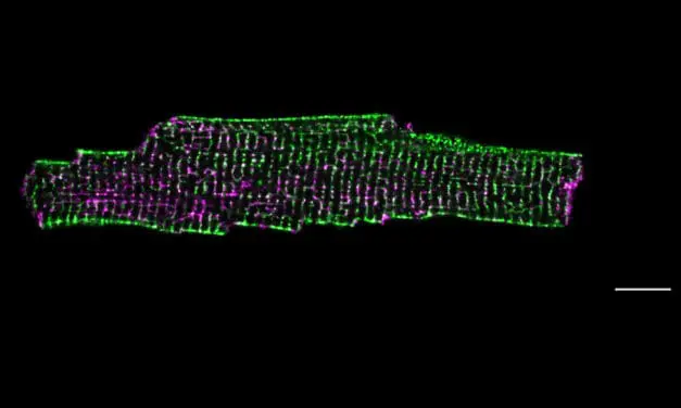 Herzschwäche: Protein Dysferlin schützt und formt die Membran von Herzmuskelzellen