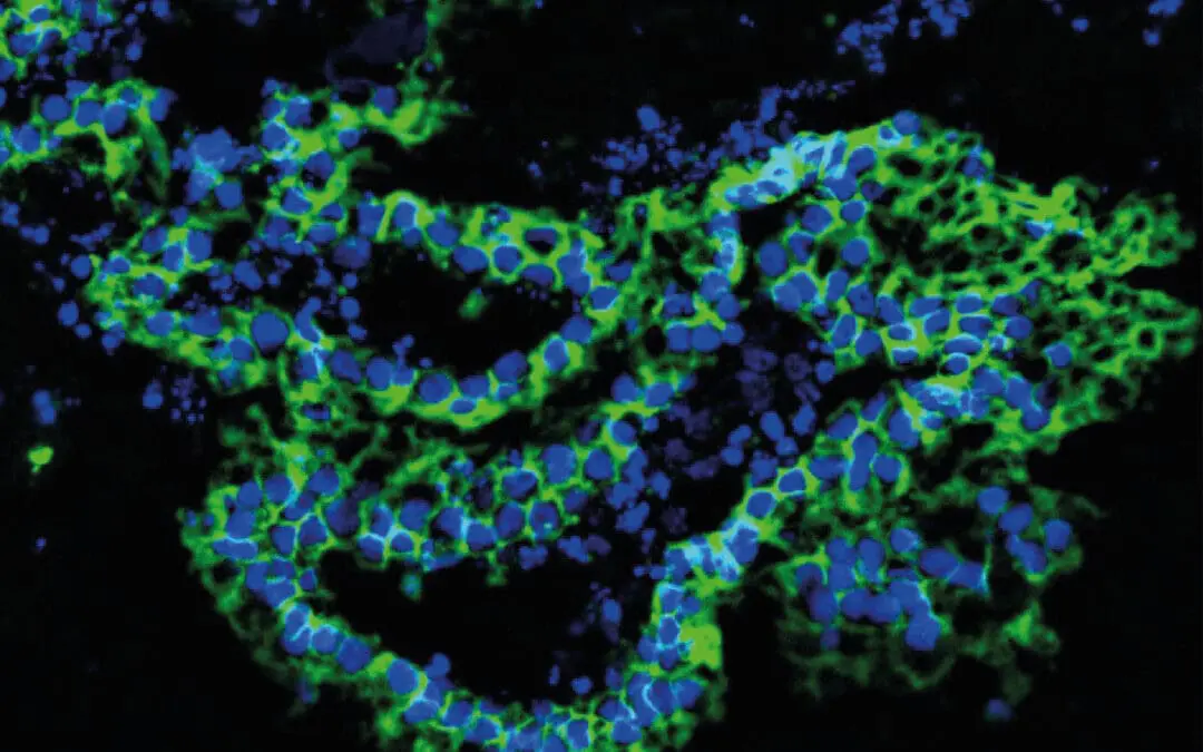 Qualitätskontrolle für Markergene: IUF ist Verbesserung der Standardisierung gelungen
