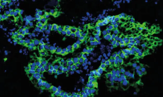 Qualitätskontrolle für Markergene: IUF ist Verbesserung der Standardisierung gelungen