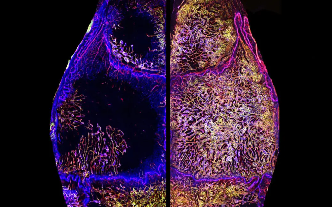 Ohne Ende: Knochenmark im Schädel wächst ein Leben lang