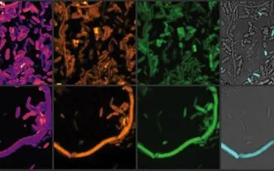 Parkinson-Medikament Entacapon verändert das Darmmikrobiom negativ