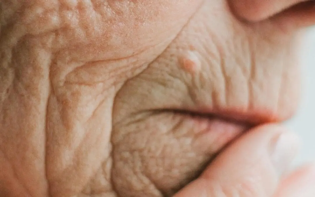 Magdeburger Forschungsprojekt sucht Parkinson-Patienten für „NeuroDance Programm“