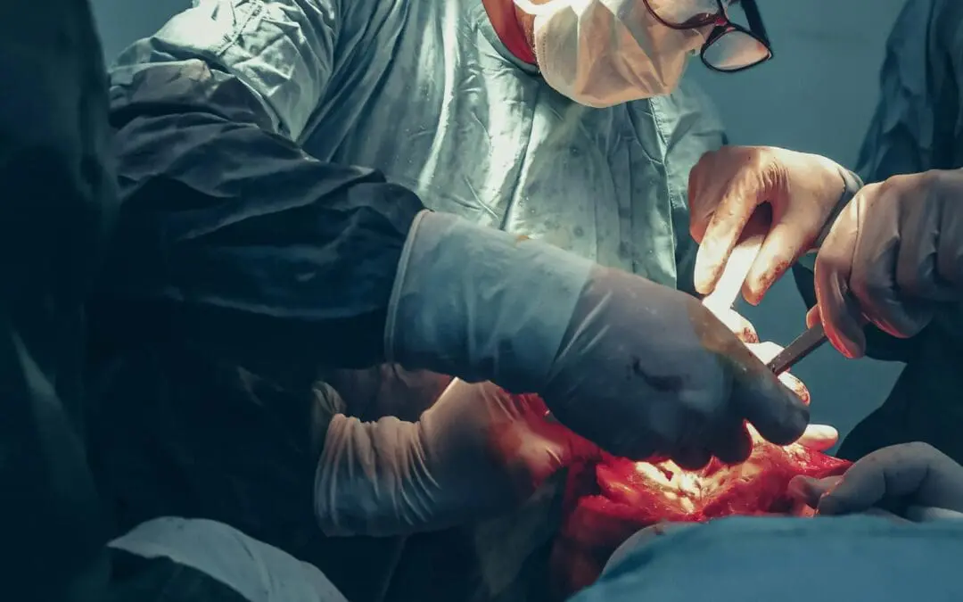 ACC.25: Prothrombinkonzentrat ist gefrorenem Plasma bei der Kontrolle von Blutungen während einer Herzoperation überlegen