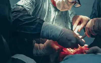 ACC.25: Prothrombinkonzentrat ist gefrorenem Plasma bei der Kontrolle von Blutungen während einer Herzoperation überlegen