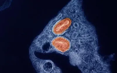 Mpox: Tecovirimat erweist sich als wirkungslos