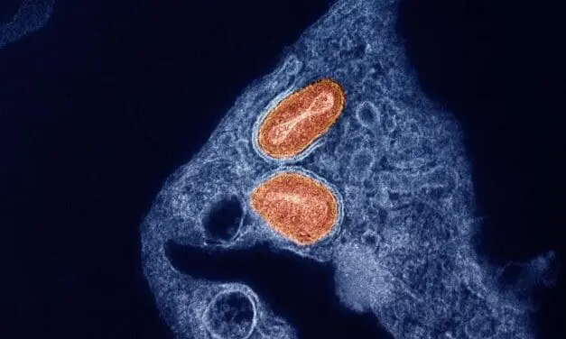 Mpox: Tecovirimat erweist sich als wirkungslos