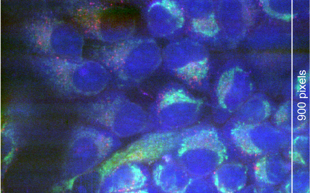 Verbesserte Raman-Mikroskopie von kryofixierten Proben geglückt
