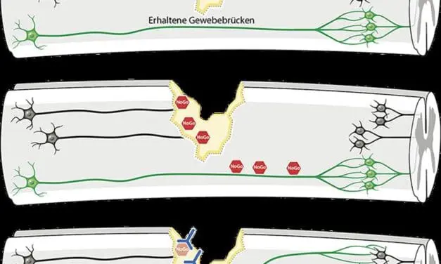 Antikörper-Therapie kann Nervenregeneration bei Querschnittslähmung verbessern