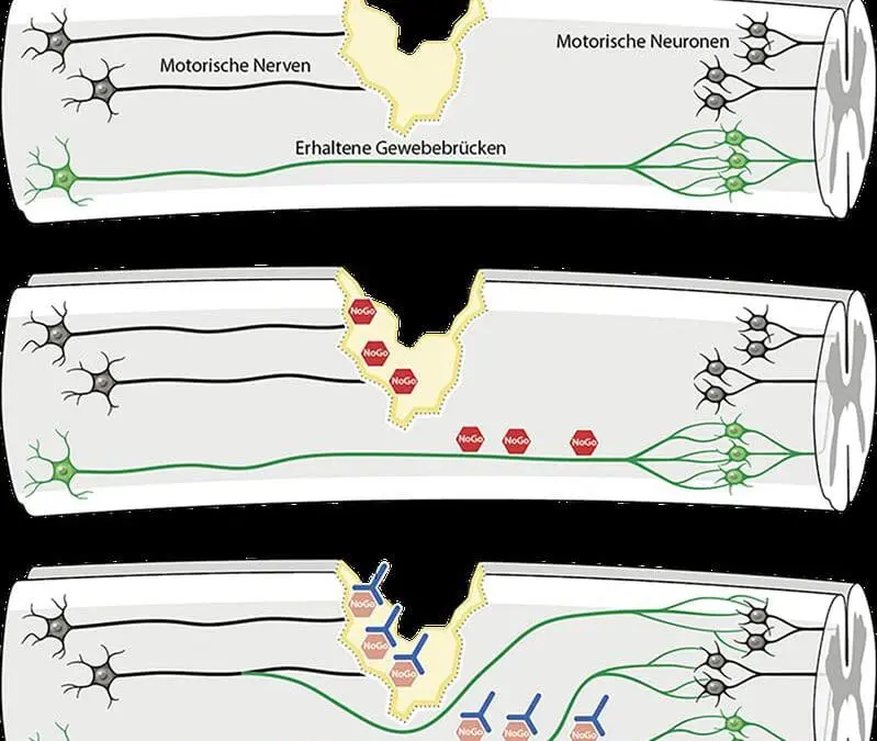 Antikörper-Therapie kann Nervenregeneration bei Querschnittslähmung verbessern