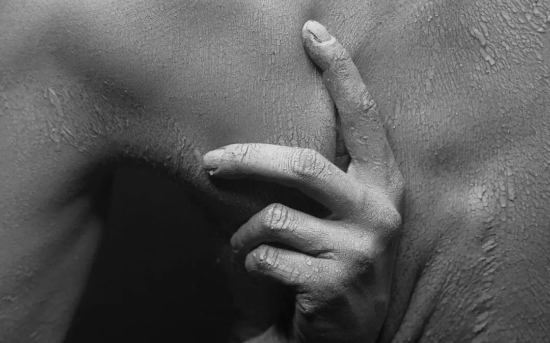 Fehlen eines bestimmten Proteins schützt vor Candida albicans-Infektionen