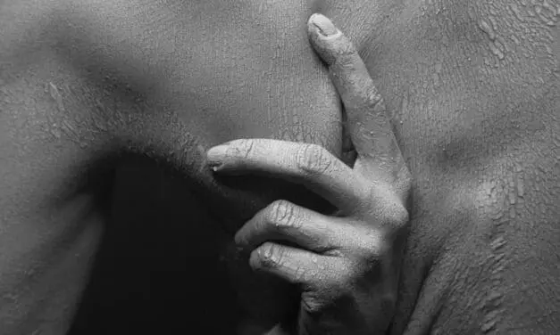 Fehlen eines bestimmten Proteins schützt vor Candida albicans-Infektionen