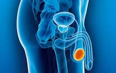Hodenkrebs: Atlas der verschiedenen Dottersacktumor-Subtypen im Fokus