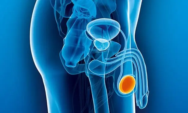 Hodenkrebs: Atlas der verschiedenen Dottersacktumor-Subtypen im Fokus