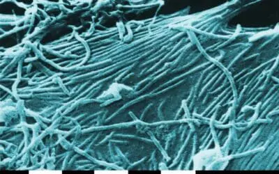 Ebola-Infektion über Hautoberfläche möglich