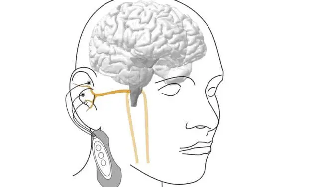 „Elektrische Pille“ für den Parasympathikus: Bedingt einsatzbereit