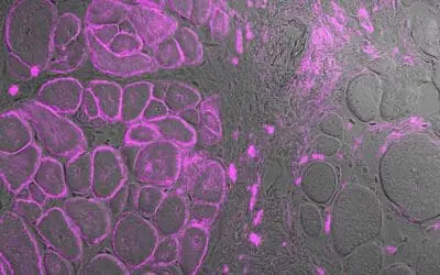 CRISPR: Genschere soll Muskelschwund bekämpfen