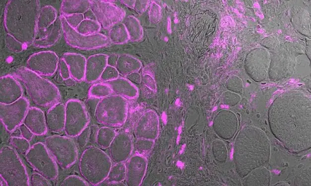 CRISPR: Genschere soll Muskelschwund bekämpfen