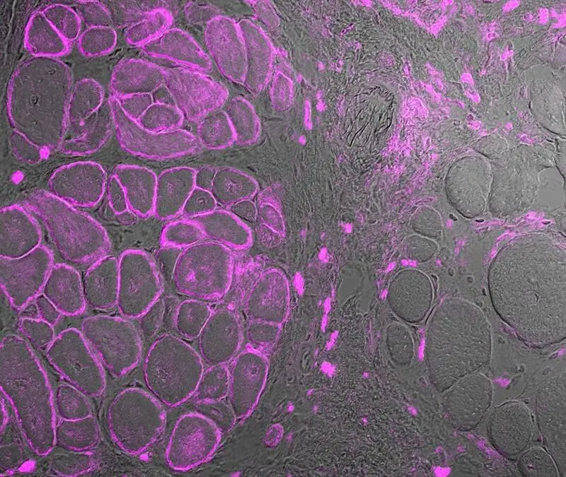 CRISPR: Genschere soll Muskelschwund bekämpfen