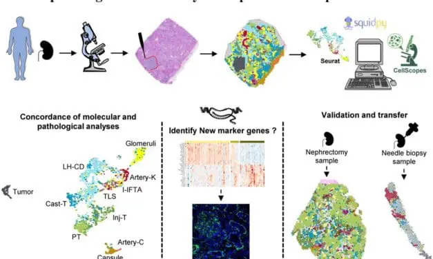 Biomarker: Innovative Technologie verbessert die zellulären und molekularen Einblicke in Nierenläsionen