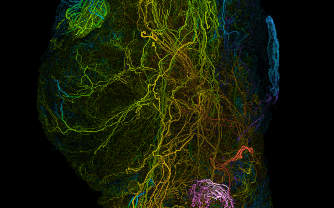 Nerven-Blockade ist eine mögliche Behandlungsstrategie bei Bauchspeicheldrüsenkrebs
