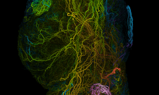 Nerven-Blockade ist eine mögliche Behandlungsstrategie bei Bauchspeicheldrüsenkrebs