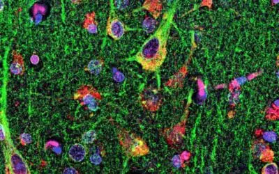 MLC1 als potentielles Zielantigen bei MS ausgemacht