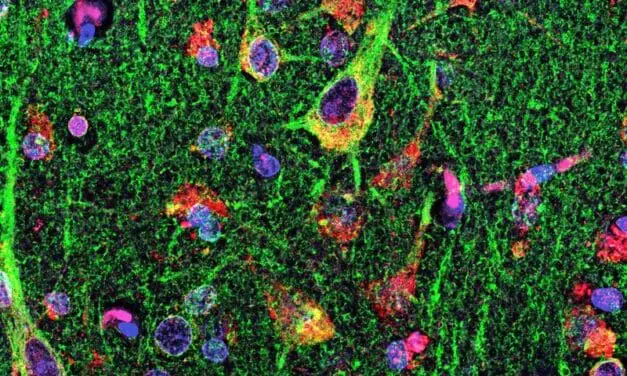 MLC1 als potentielles Zielantigen bei MS ausgemacht