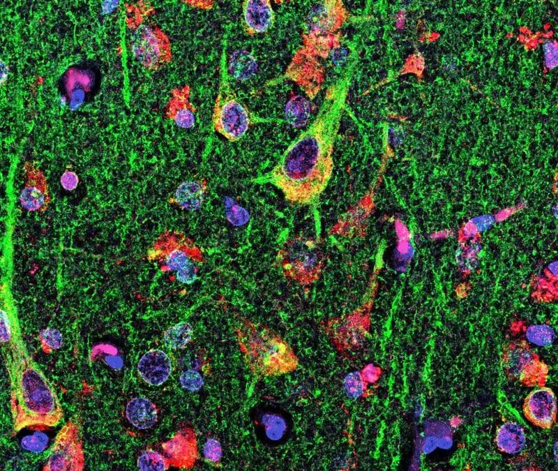 MLC1 als potentielles Zielantigen bei MS ausgemacht
