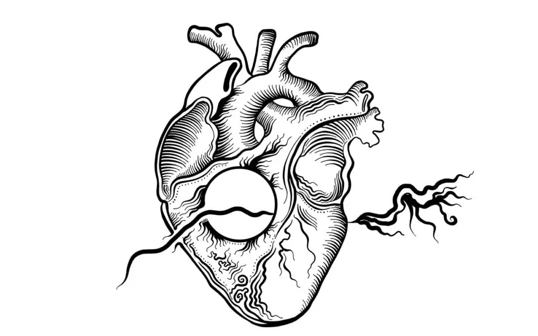 KI verbessert Risikoeinschätzung bei häufigster Herzinfarktform