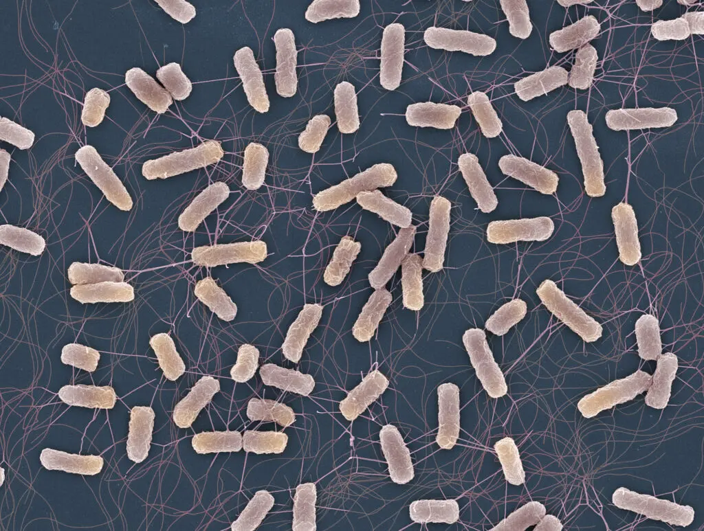 Rasterelektronenmikroskopische Aufnahme von Salmonella-Bakterien. (Credits: Universität Basel, Biozentrum/Swiss Nanoscience Institute, Nano Imaging Lab)