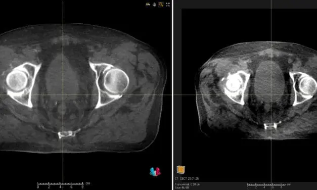 Uniklinikum Carl Gustav Carus Dresden setzt weltweit erstmals KI-gestützte Bildgebung mit Versa HD ein