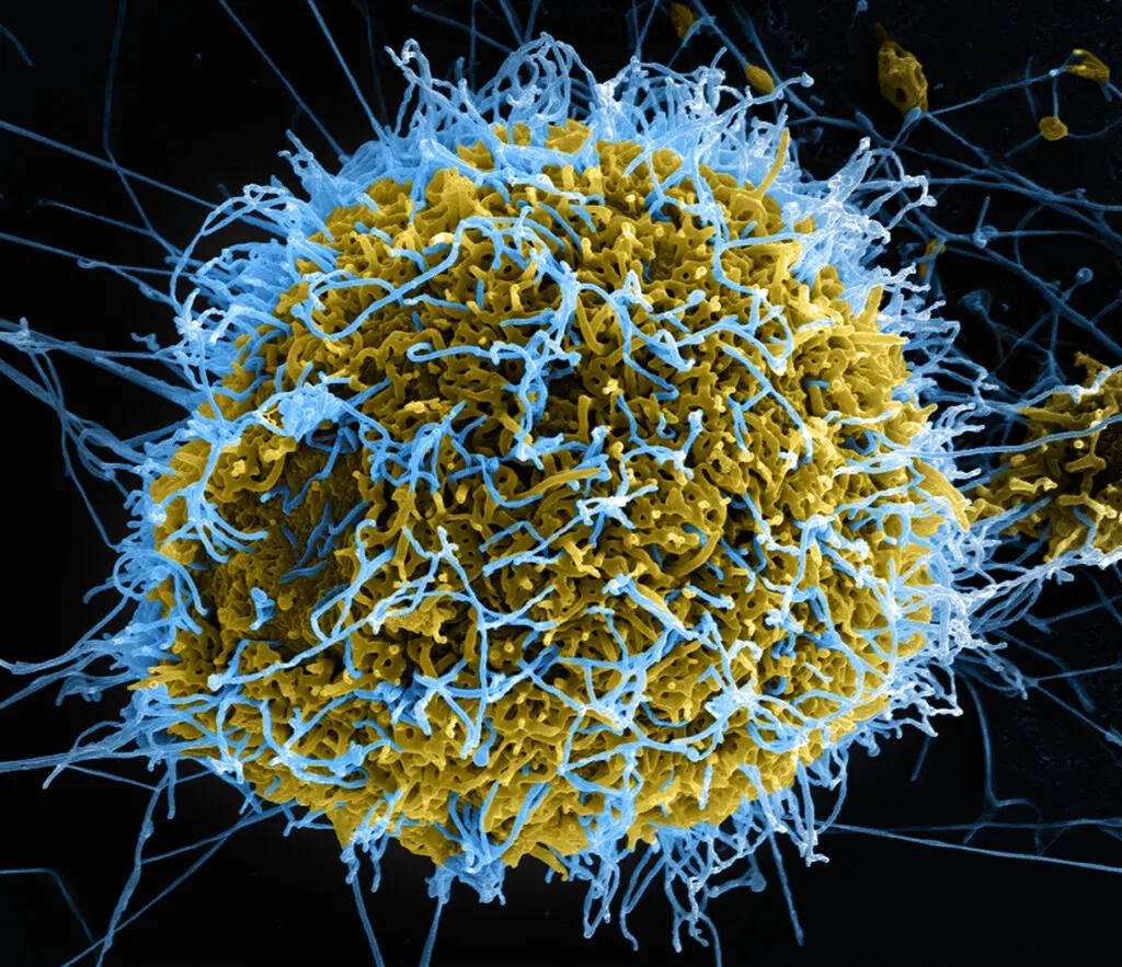 Kolorierte rasterelektronenmikroskopische Aufnahme von filamentösen Ebolavirus-Partikeln (blau), die aus einer chronisch infizierten Zelle (gelb-grün) einer Zellkulturlinie austreten. (Credits: NIAID/NIH)