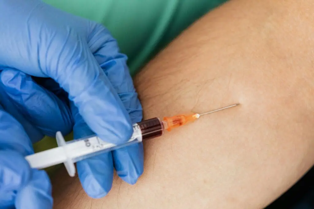 Blutproteine haben auch eine große diagnostische Bedeutung. Veränderungen in der Konzentration bestimmter Plasmaproteine können auf verschiedene Krankheiten hinweisen. (Credits: Kaboompics.com/pexels)