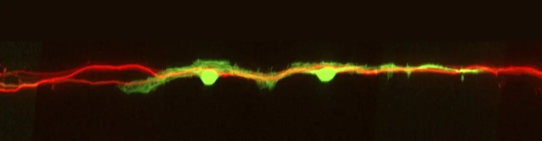 Entfernung von HDAC8 ermöglicht schnellere Regeneration von Nervenzellen