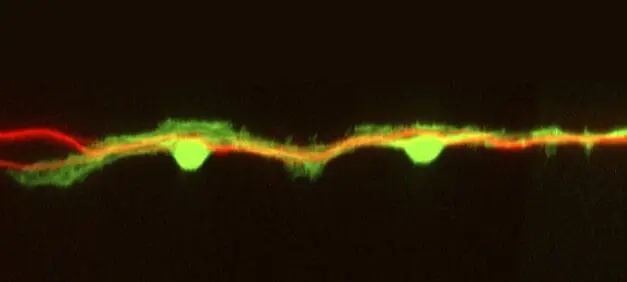 Entfernung von HDAC8 ermöglicht schnellere Regeneration von Nervenzellen