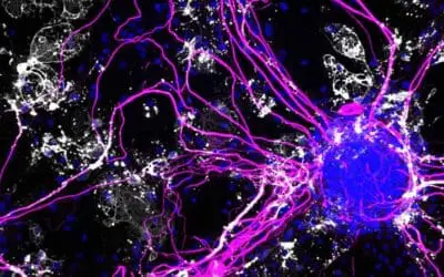 IL-12 verschlimmert Alzheimer massiv