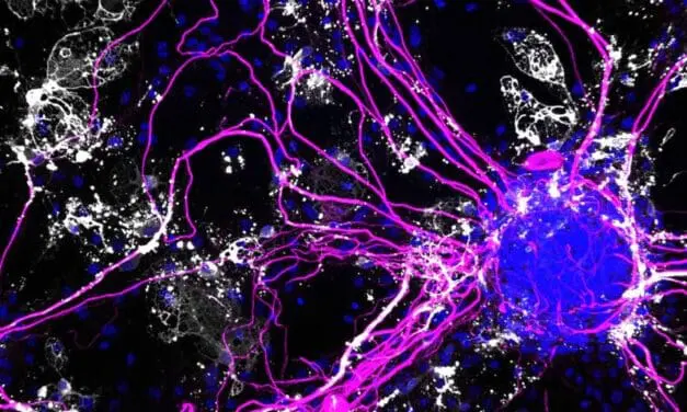 IL-12 verschlimmert Alzheimer massiv
