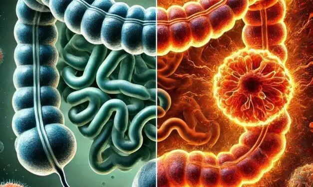 Darmkrebs: Protein HKDC1 beeinflusst Tumorwachstum