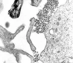 Unreife Thrombozytenfraktion als klinischer Prädiktor für verbesserte Thrombozytenerholung bei Patienten mit Dengue-Fieber