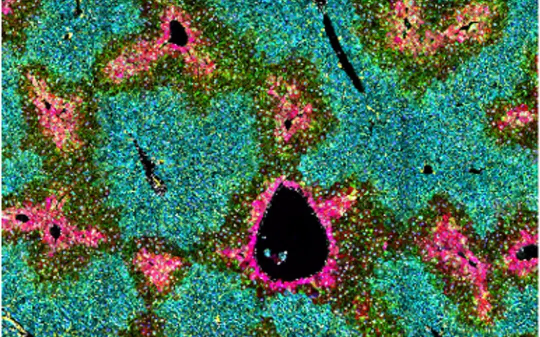 Wissenschaftler klären Funktion hepatischer Sternzellen in der Leber