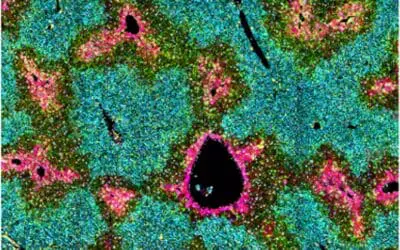 Wissenschaftler klären Funktion hepatischer Sternzellen in der Leber