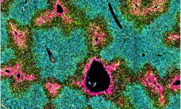 Wissenschaftler klären Funktion hepatischer Sternzellen in der Leber