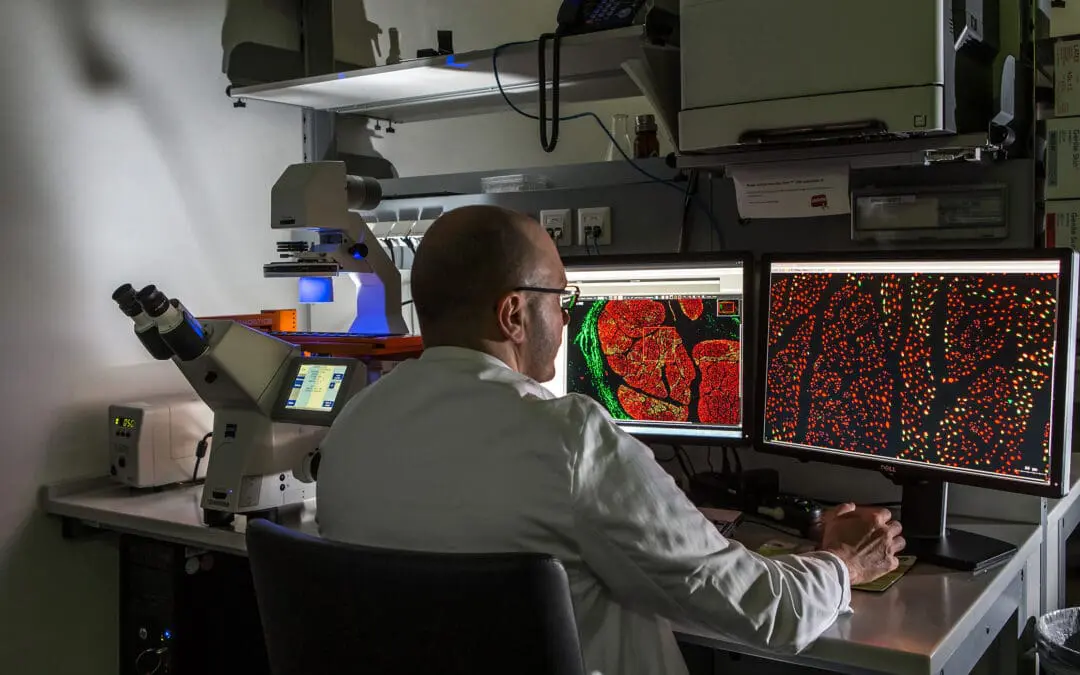 Semisynthetische Gallensäure wirkt entzündungshemmend auf den Darm