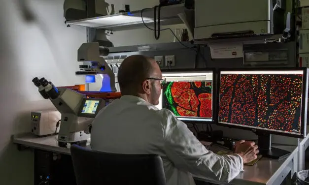 Semisynthetische Gallensäure wirkt entzündungshemmend auf den Darm