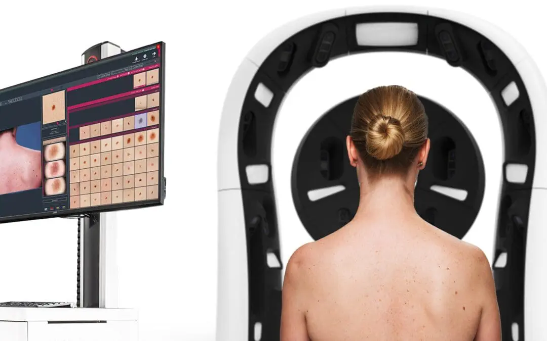 KI-Diagnoseplattform kann Hautkrebs schnell, effizient und fehlerfrei erkennen