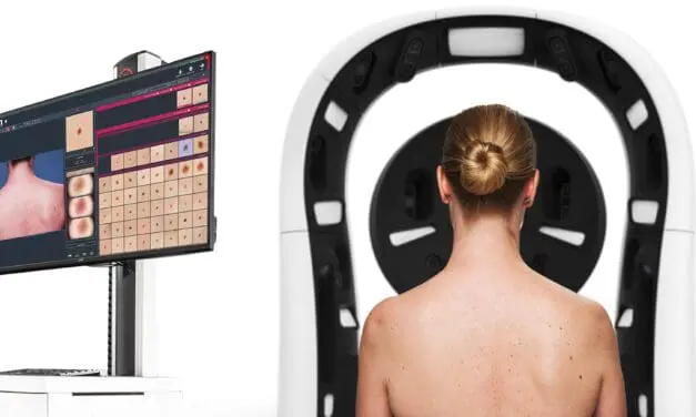 KI-Diagnoseplattform kann Hautkrebs schnell, effizient und fehlerfrei erkennen