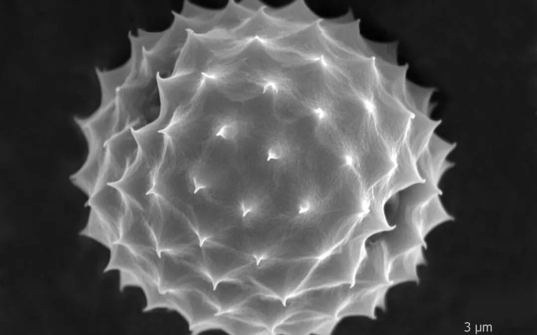 Pollenflug in Berlin: Charité bietet App für Allergiker an