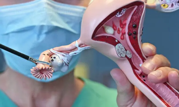 Prophylaktische Entfernung der Eileiter kann Krebsfälle und Gesundheitskosten deutlich reduzieren